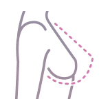 BREAST