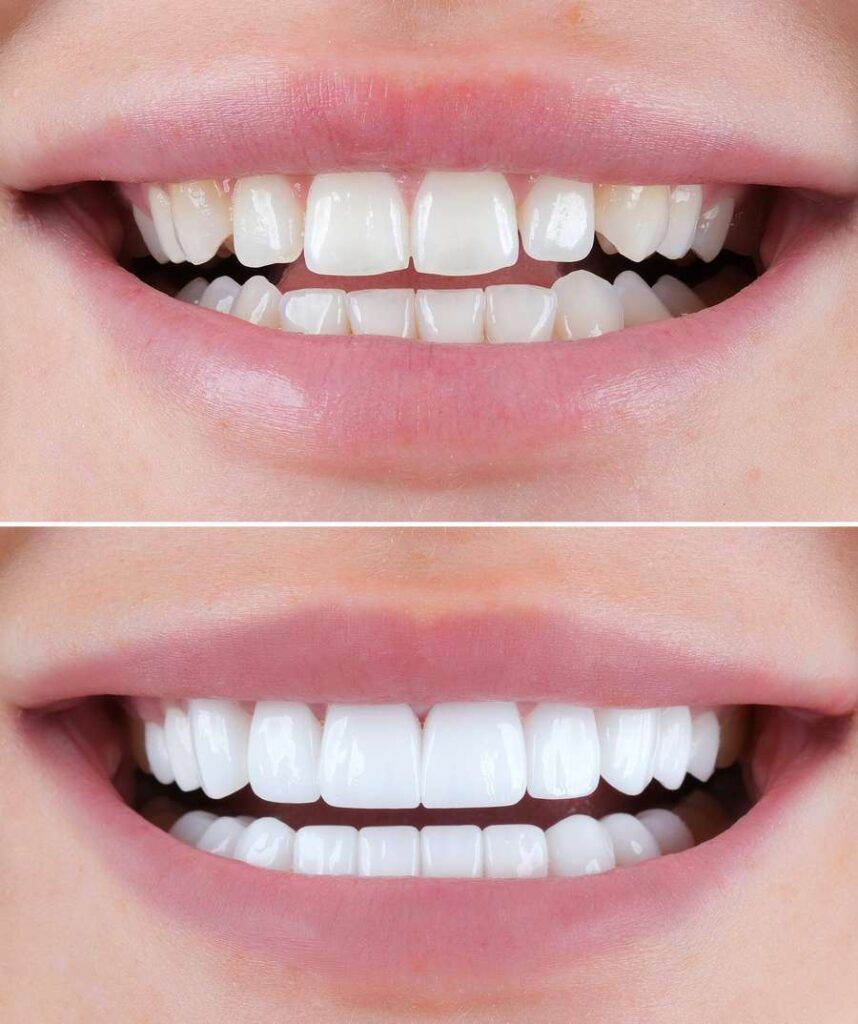 Dentist in Bodrum
