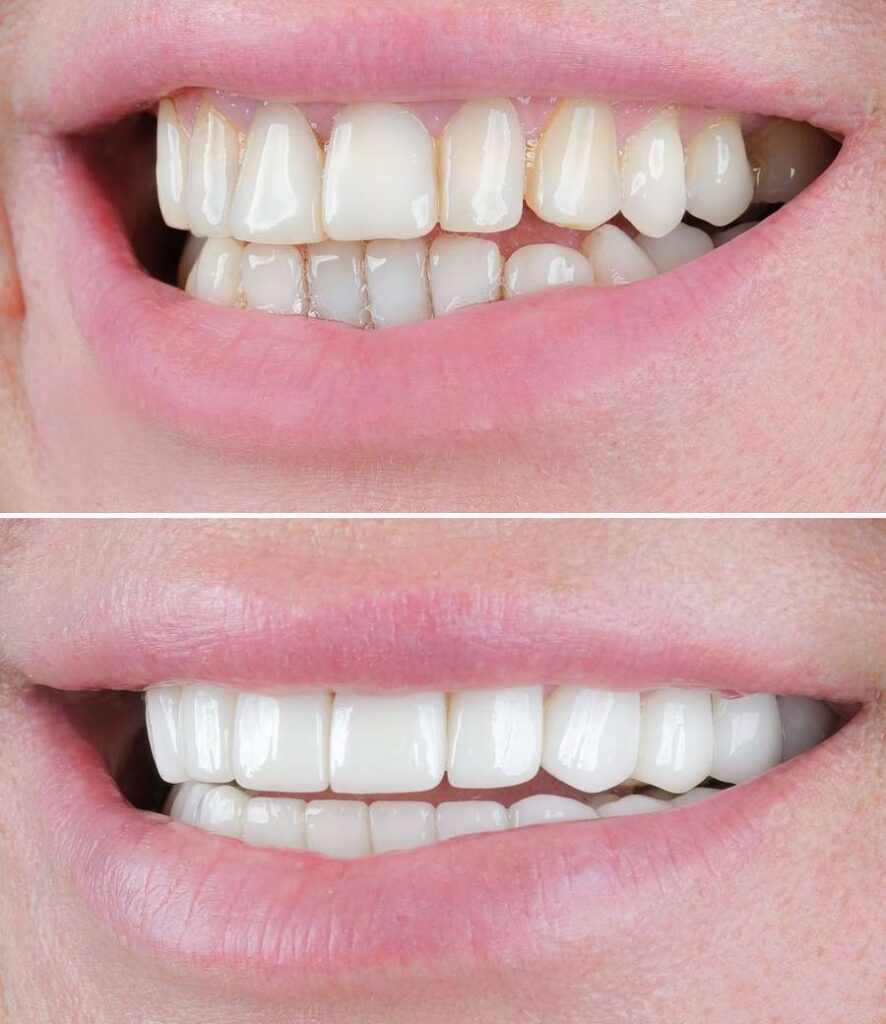 Dentist in Bodrum