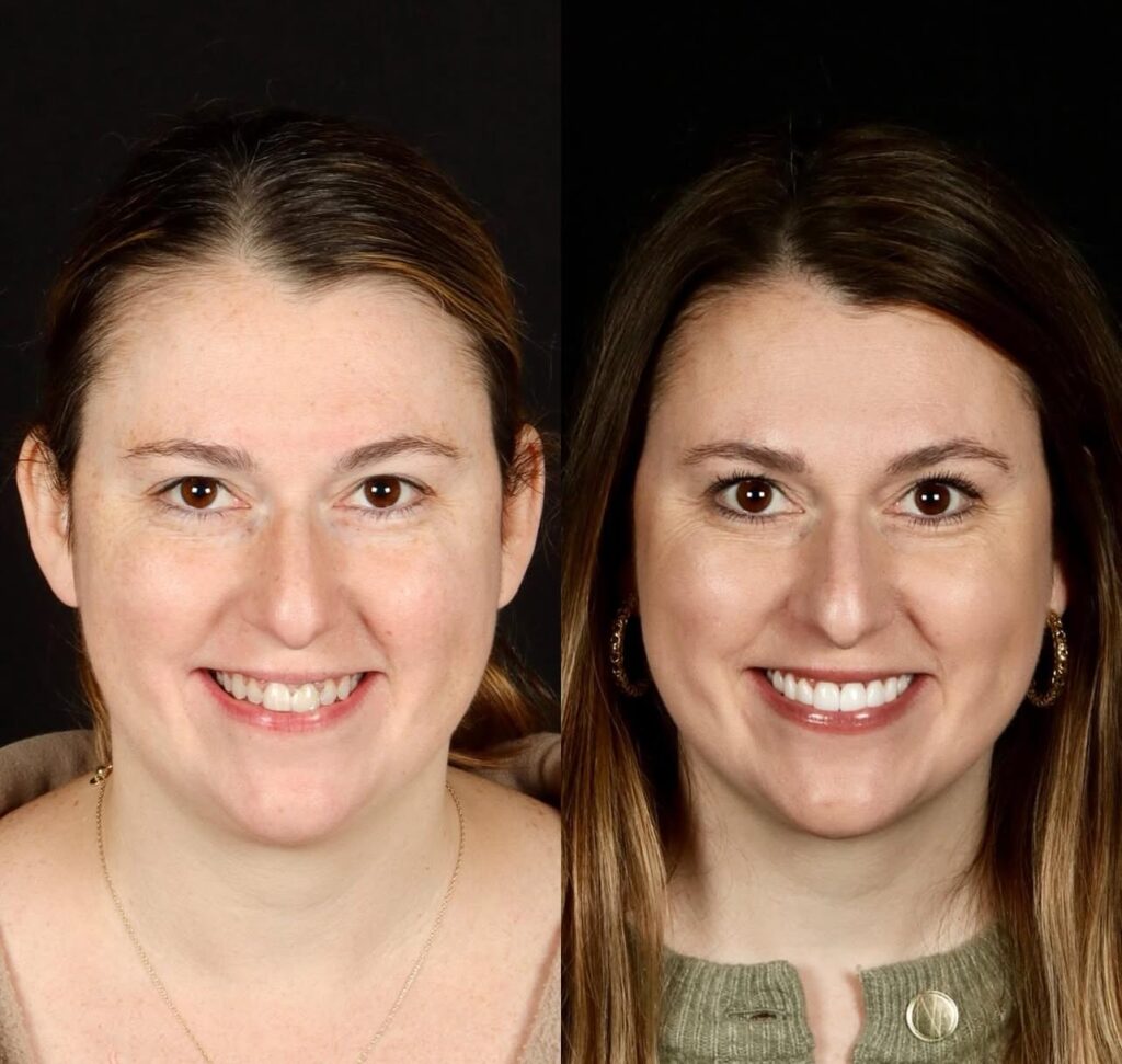 Transform Your Smile