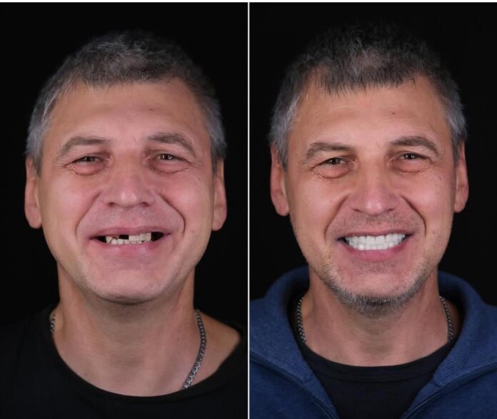 Dental Tourism in Bodrum, Turkey