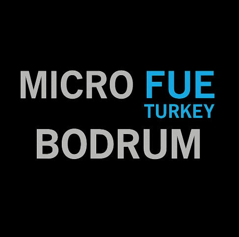 HAIR TRANSPLANT COST IN BODRUM, TURKEY Micro FUE Turkey Bodrum clinic natural hairline design and affordable premium treatment