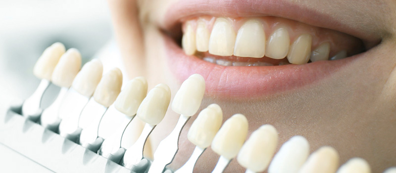 Dental Treatment and Aesthetics Bodrum